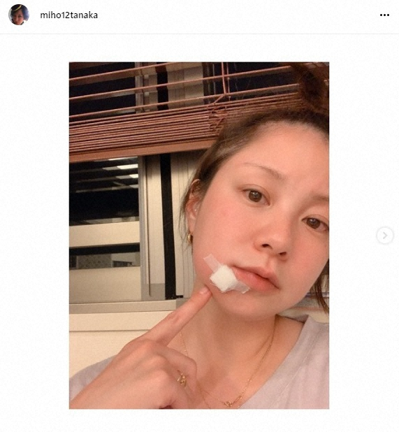【画像・写真】マスクの肌荒れ注意！田中美保「細胞の水分が失われやすい」医師から聞いた対策明かす
