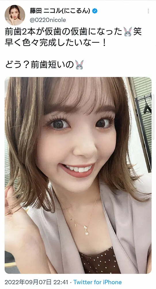 【画像・写真】藤田ニコル　短い前歯の“仮歯の仮歯”姿披露に「自然！」「より大人っぽい」の声