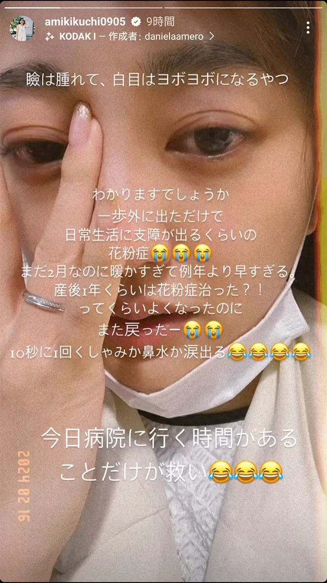 【画像・写真】菊地亜美「暖かすぎて」花粉症もう発症「瞼は腫れて、白目はヨボヨボ」「日常生活に支障が出る」と悲鳴